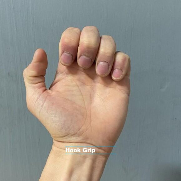 Left hand palm is facing us, with fingers bent forward in a 'hook grip' position